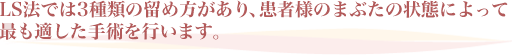 LS法では3種類の留め方があり、患者様のまぶたの状態によって最も適した手術を行います。